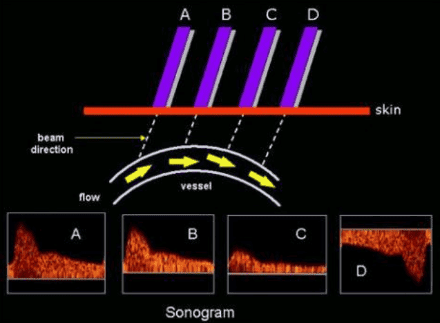 Introduction to Echocardiography