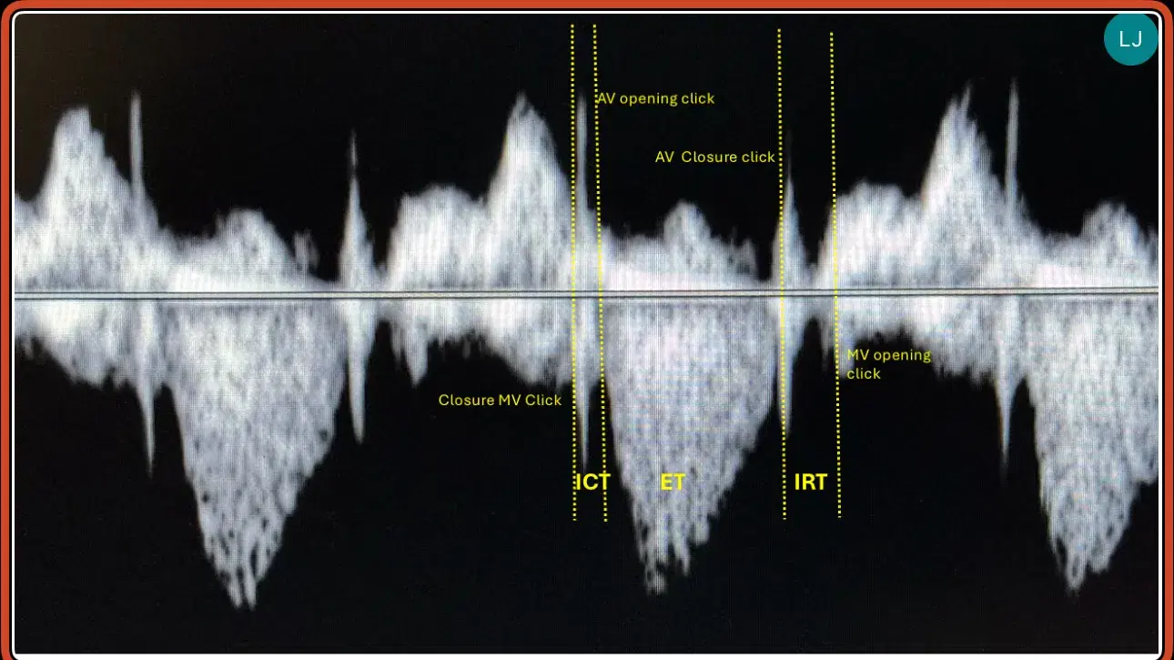  Mastering the Fetal Tei Index: A Comprehensive Ultrasound Journey