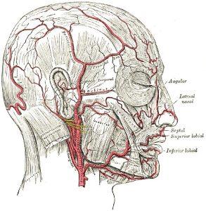 Temporal Artery Doppler Ultrasound