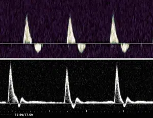 Arterial and Venous Doppler Waveform Nomenclature