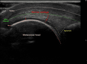 Ultrasound Diagnosis of Arthritis Using a Standardized Approach