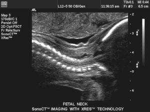 Principles of OB-GYN Sonography