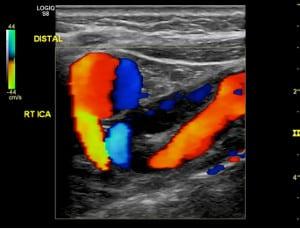 Intermediate and Non-Atherosclerotic Cerebrovascular Imaging