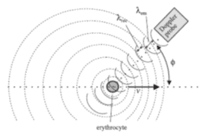 Transcranial Doppler