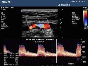 Principles of Vascular Sonography