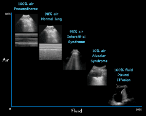 Lung Ultrasound in COVID-19