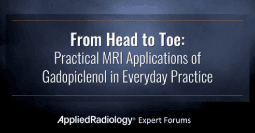 From Head to Toe: Practical MRI Applications of Gadopiclenol in Clinical Practice
