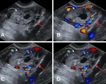 Ectopic Pregnancy Course Banner Image