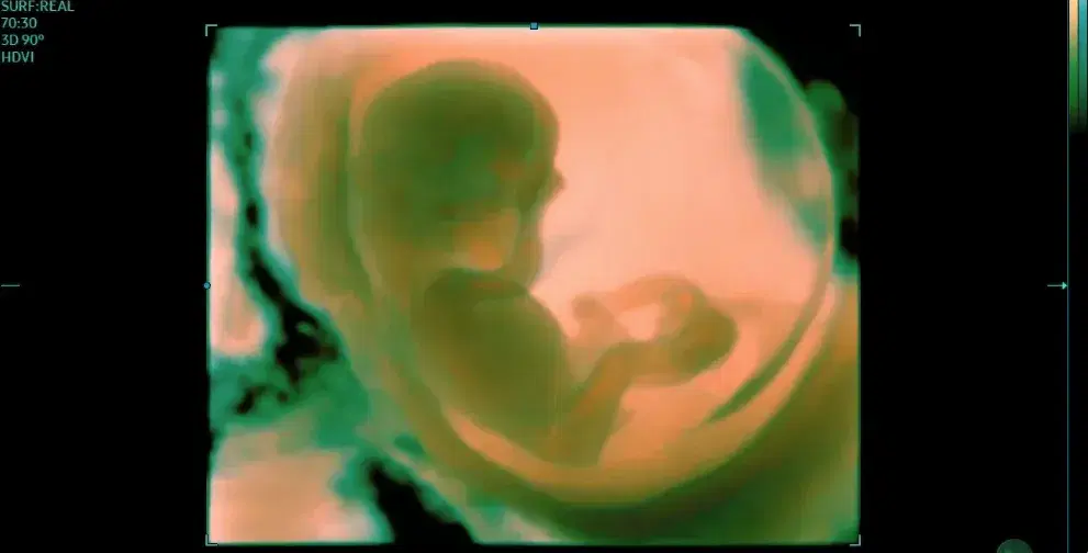 Fetal Ultrasound Course Banner Image