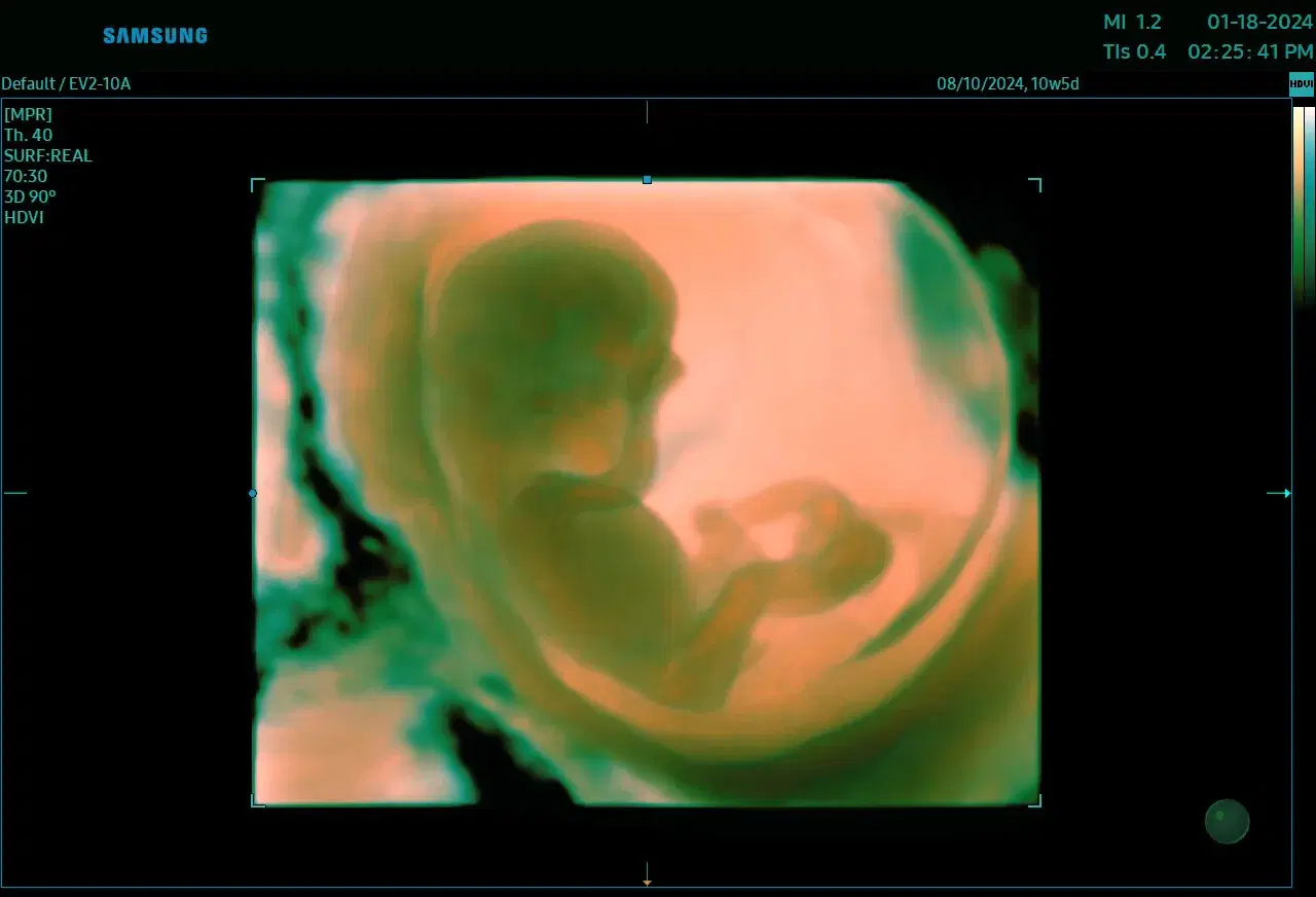 Advanced Fetal Ultrasound: Innovations & Insights for Early First Trimester Assessment