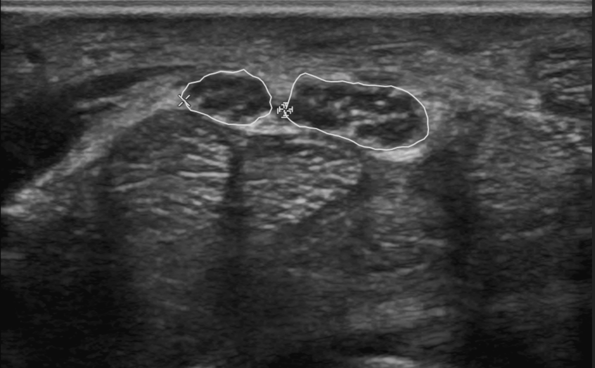 WCRG Peer Learning RSS 2025