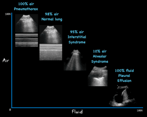 Lung Ultrasound in COVID-19