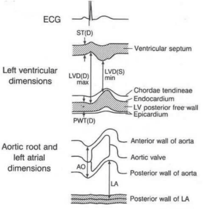 Introduction to Echocardiography Pt 1